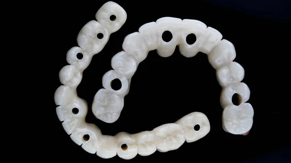 Composición Prótesis Dentales Para Mandíbula Inferior Superior Vista Superior Sobre —  Fotos de Stock