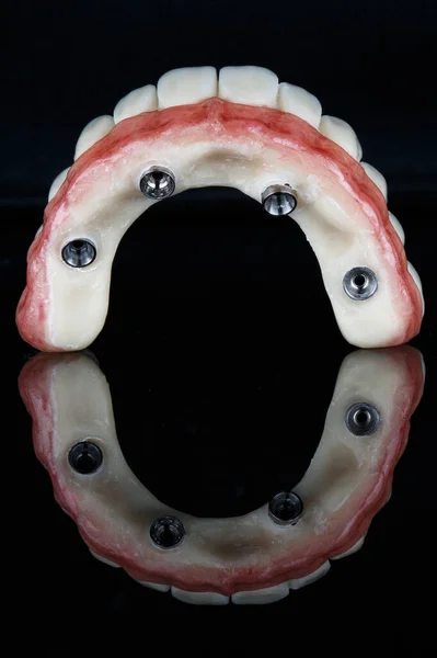 Excellent Upper Jaw Prosthesis Black Glass Reflection — Stock Photo, Image