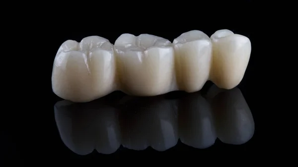 Зубной Мост Циркония Представляет Собой Небольшой Протез Жевательной Части Челюсти — стоковое фото