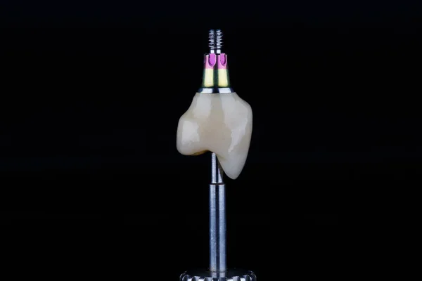 Виготовлений Стоматологом Техніком Циркону Ортопедичної Викрутки Знятої Чорному Тлі — стокове фото