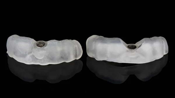 Dvě Zubní Šablony Pro Implantaci Jednoho Implantátu Černé Pozadí — Stock fotografie