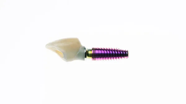 Coroa Dental Implante Todo Tiro Fundo Branco — Fotografia de Stock