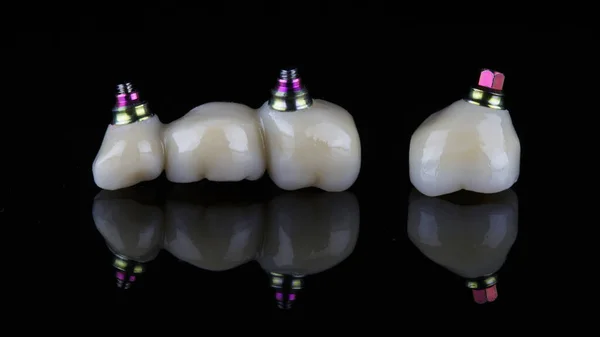 Dentystyczny Most Cyrkonowy Pojedyncza Korona Czarnym Szkle Odbiciem — Zdjęcie stockowe