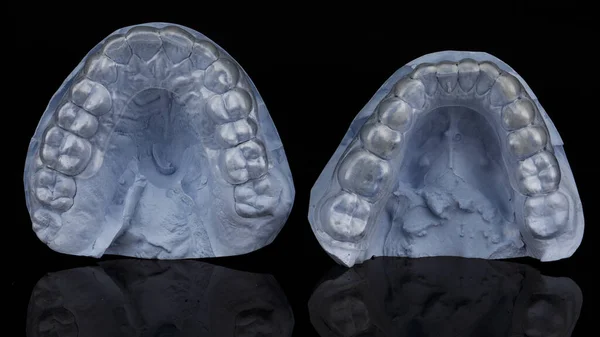 Two Dental Caps Gypsum Models Shown Occlusal Side Black Background — Stock Photo, Image