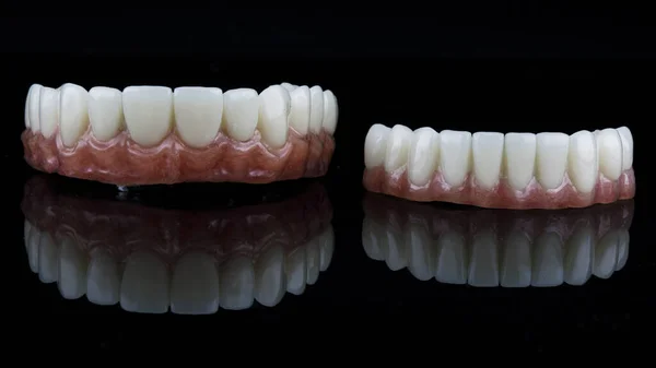 下顎と上顎のためのピンクのガムを持つ義歯の優れた組成物は 反射して黒の背景に撮影 — ストック写真