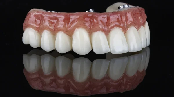 Pracowała Tymczasowa Proteza Wysokiej Jakości Technik Dentystyczny Proteza Różową Gumą — Zdjęcie stockowe