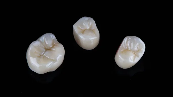 Three Dental Crowns Made Quality Ceramics Anatomy Chewing Teeth Shot — Stock Photo, Image