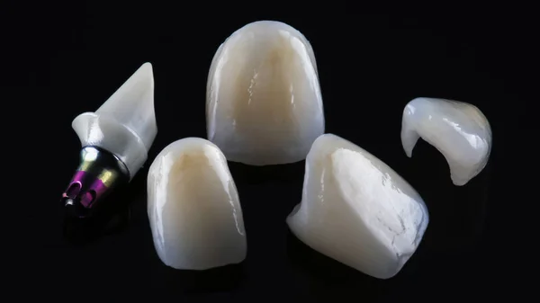 Pilar Dental Feito Zircão Coroas Cerâmica Fundo Preto — Fotografia de Stock