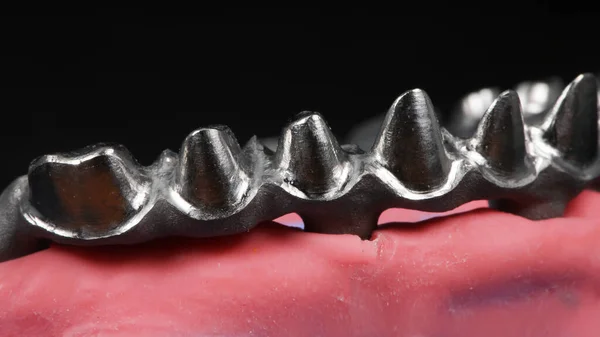 Fragmento Vigas Dentales Con Goma Artificial Sobre Fondo Negro —  Fotos de Stock