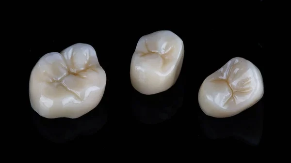Trzy Wysokiej Jakości Korony Dentystyczne Czarnym Tle — Zdjęcie stockowe