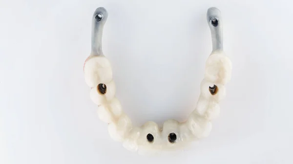 白い背景の上から見た高品質の一時的な歯科用義歯 — ストック写真