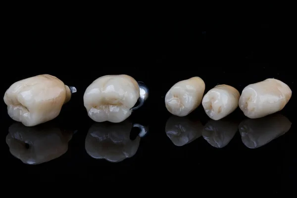 Ottima Composizione Corone Ceramica Denti Masticare Vetro Nero — Foto Stock