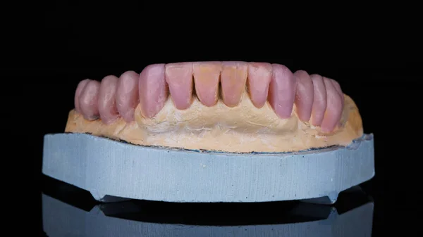 Artificial Teeth Wax Lower Jaw Black Background — Stock Photo, Image