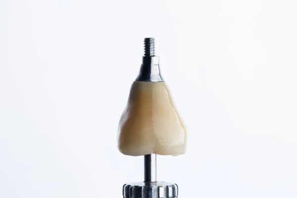 Coroa Dentária Terminou Com Próteses Ortopédicas Fundo Branco — Fotografia de Stock