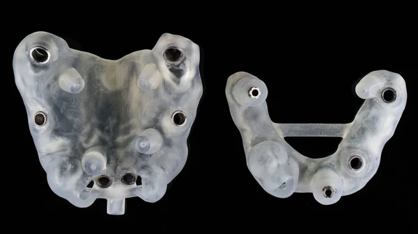 Modelos Dentários Especiais Para Implantação Duas Mandíbulas Fundo Preto Vista — Fotografia de Stock