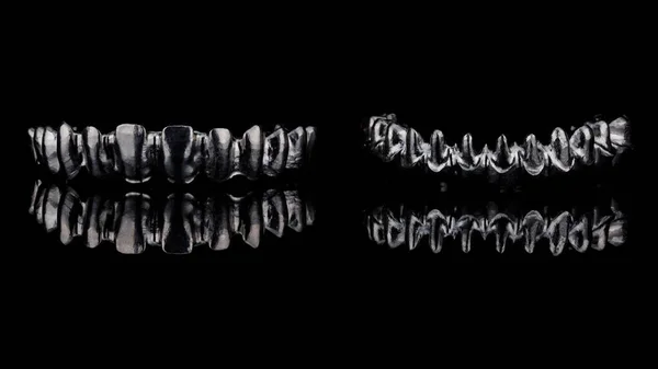 Hermosa Composición Barras Dentales Titanio Mandíbula Inferior Superior Para Creación —  Fotos de Stock