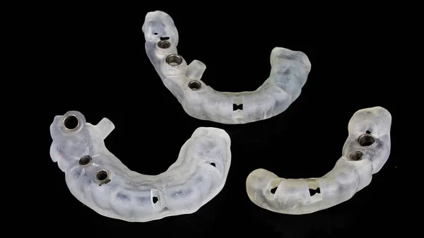 歯の端の欠陥の領域に移植するための外科用テンプレートのセット — ストック写真