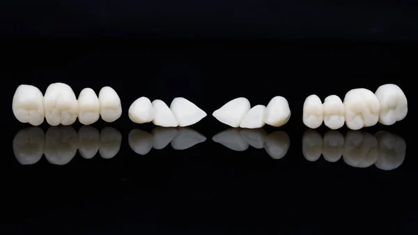 Chapas Dentales Temporales Coronas Resina Colocadas Sobre Vidrio Negro Con —  Fotos de Stock