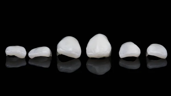 Ceramic Dental Veneers Lower Jaw Central Incisors Filmed Black Glass — Stock Photo, Image