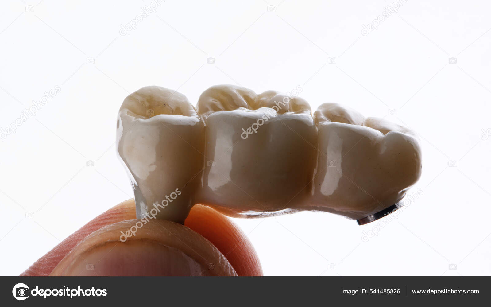 Beautiful Dental Bridge Three Teeth Filmed Hand White Background Stock