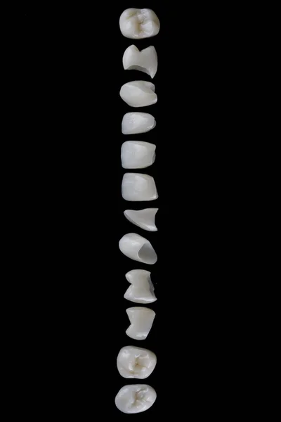 Wysokiej Jakości Okleiny Dentystyczne Ceramicznych Koron Wykonane Góry Czarnym Tle — Zdjęcie stockowe