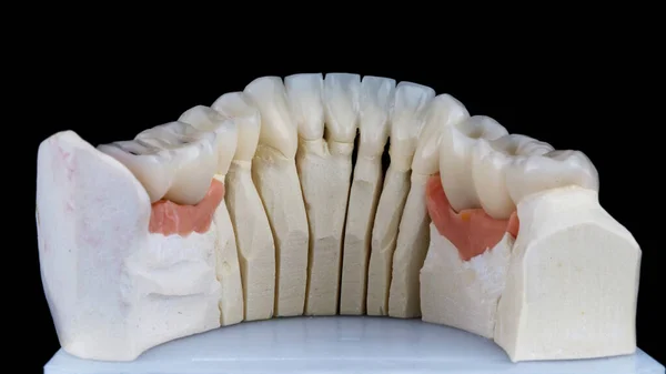 Mold of teeth. Gypsum model plaster of teeth. Stomatologic plaster cast,  molds of human jaws and teeth on gray background. Dentistry and  orthodontics concept Stock Photo