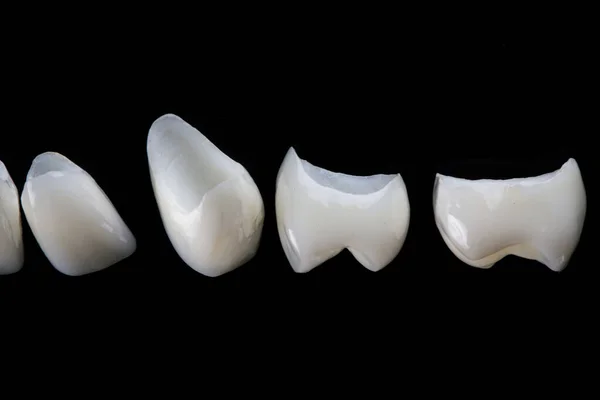 Foto Close Folheados Dentários Feitos Cerâmica Vidro Fundo Preto — Fotografia de Stock
