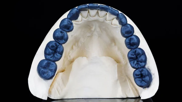 Wachsmodell Der Morphologischen Ansicht Des Unterkiefers Gefilmt Auf Schwarzem Glas — Stockfoto