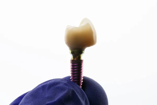 Coroa Dentária Temporária Implante Réplica Mão Médico Fundo Branco — Fotografia de Stock