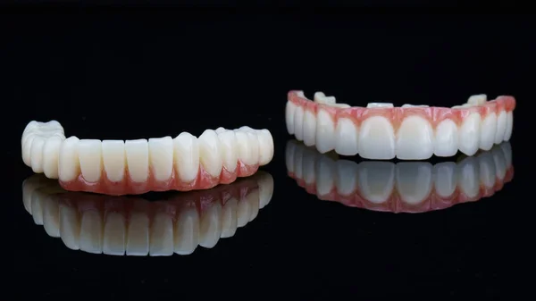 上顎と下顎のための一時的な歯科用義歯で黒い背景に人工歯があります — ストック写真