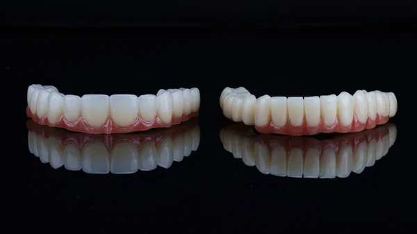 Dos Prótesis Dentales Temporales Para Las Mandíbulas Superior Inferior Extraídas —  Fotos de Stock