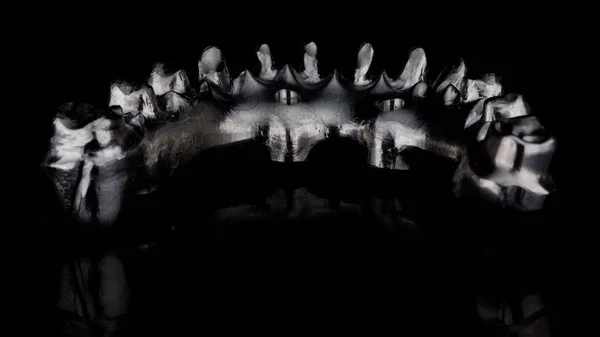 Barra Titânio Dental Mandíbula Inferior Partir Interior Filmado Vidro Preto — Fotografia de Stock