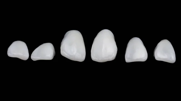 Творческая Композиция Зубных Шпонов Нижней Челюсти Вид Сверху Черное Стекло — стоковое фото