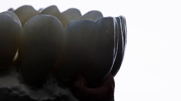 beautiful photo on the relief of dental veneers of the upper jaw, taken on a white background