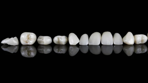 Zestaw Oklein Dentystycznych Całą Szczękę Górną Czarnym Szkle Odbiciem — Zdjęcie stockowe