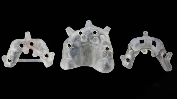 Tre Modelli Dentali Chirurgici Chirurgia Implantare Grandi Dimensioni Vista Dall — Foto Stock