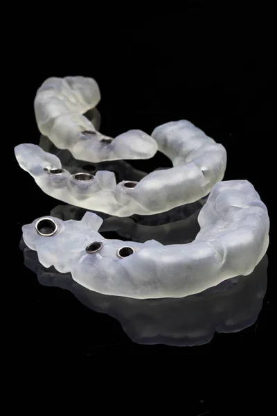 Bella Composizione Tre Modelli Chirurgici Vetro Nero Impianto Dentale — Foto Stock