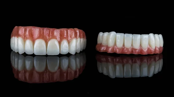 上下の顎の一時入れ歯を人工歯茎で構成し 反射して黒いガラスで撮影しました — ストック写真