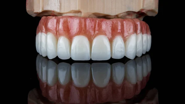 Prótesis Dental Sobre Modelo Resina Sobre Vidrio Negro Con Reflexión —  Fotos de Stock