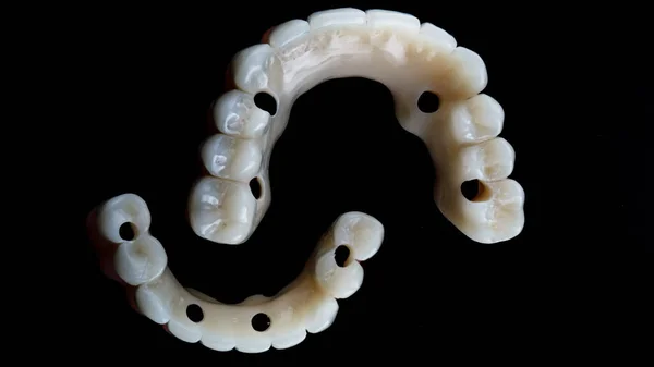 Composición Dos Prótesis Dentales Temporales Ambas Mandíbulas Disparadas Desde Arriba —  Fotos de Stock