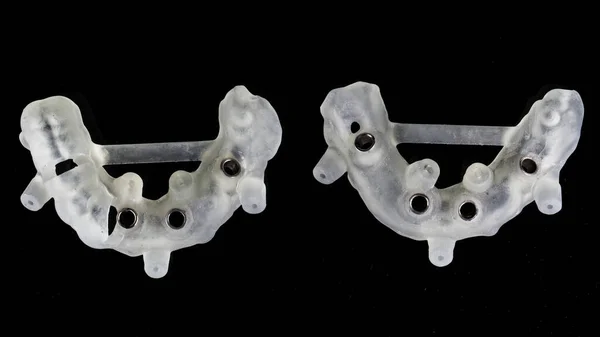 Dos Guías Dentales Quirúrgicas Para Implantación Grande Las Mandíbulas Superior — Foto de Stock