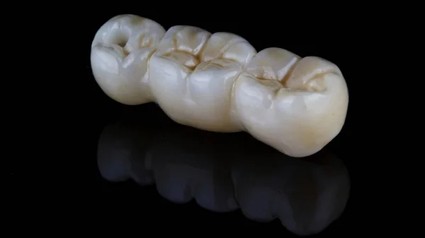 Coroa Dental Forma Uma Pequena Ponte Sobre Fundo Preto Com — Fotografia de Stock