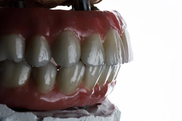 Próteses Dentárias Prontas Modelo Mordida Filmadas Com Iluminação Lateral Fundo — Fotografia de Stock