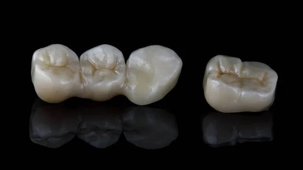Dental Crowns Onlays Black Glass Reflection Black Background — Stock Photo, Image