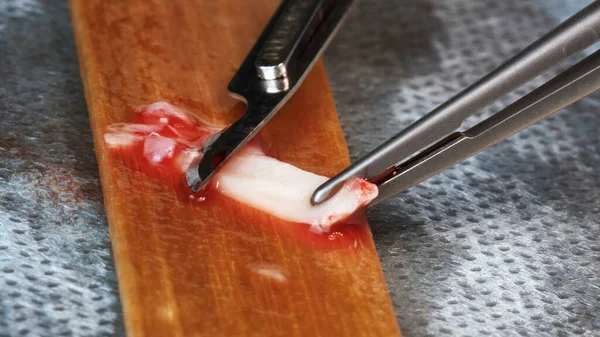 Dental Surgeon Prepares Soft Tissue Flap Scalp — Stock Photo, Image