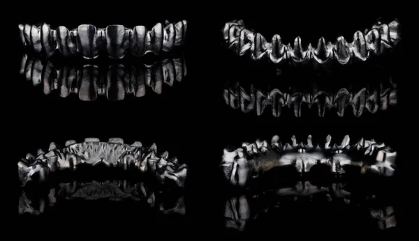 Barra Titanio Dentale Creazione Una Protesi Dentale Della Mascella Superiore — Foto Stock