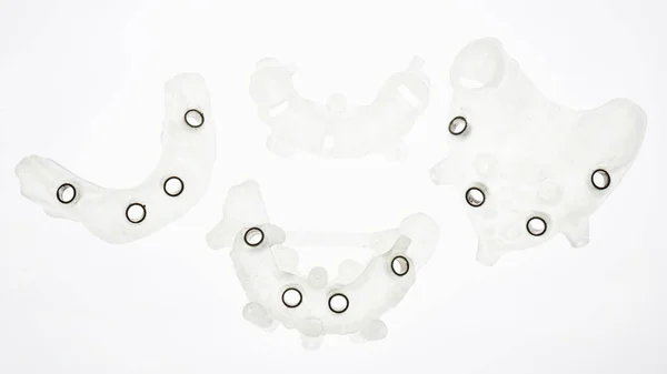 Eccellente Composizione Quattro Modelli Dentali Impianto Preciso Fondo Bianco — Foto Stock