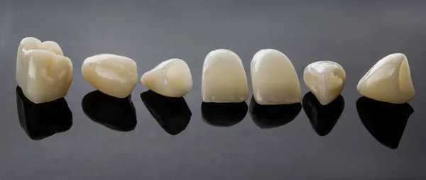 Okleiny Dentystyczne Pokryte Kompozycją Czarnym Szkle — Zdjęcie stockowe