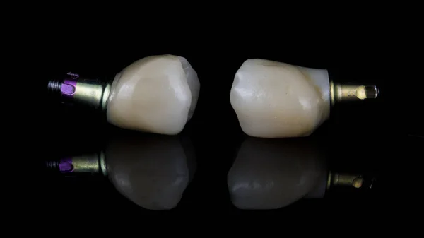 Composizione Corone Dentali Protesi Fissaggio Nella Cavità Gengivale — Foto Stock
