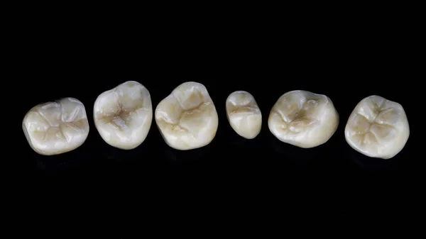 Set Ceramic Dental Inlays Macro Photo Black Background — Stock Photo, Image